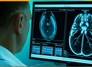 Технології штучного інтелекту в медицині