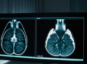 Дональд Трамп обіцяє оприлюднити результати МРТ на тлі відсутності деталей